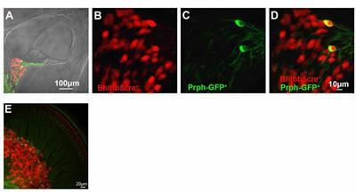 Single-Cell RNA Analysis of Type I Spiral Ganglion Neurons Reveals a Lmx1a Population in the Cochlea